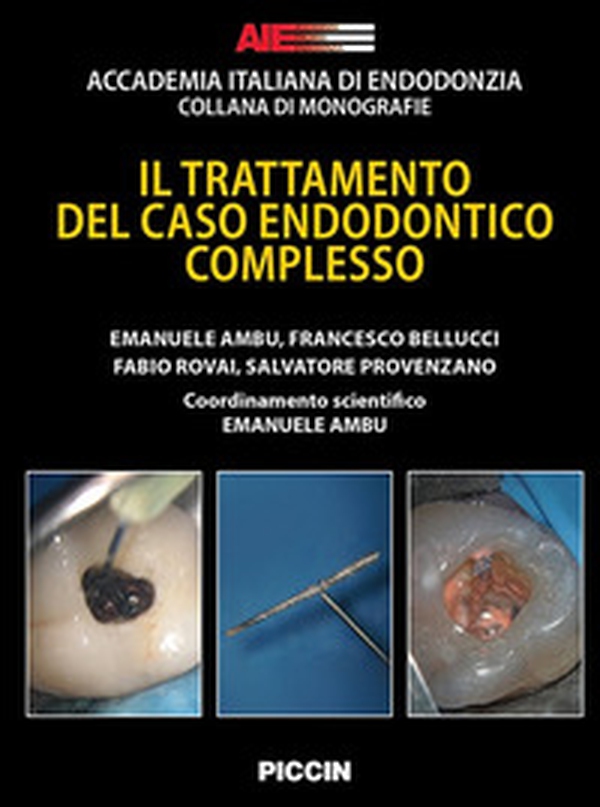 Il trattamento del caso endodontico complesso - Librerie.coop Il trattamento del caso endodontico complesso - Librerie.coop