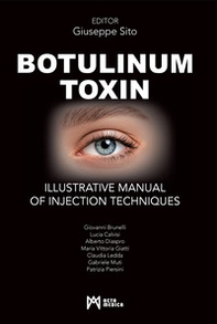 Botulinum toxin. Ilustrative manual of injection techniques - Librerie.coop