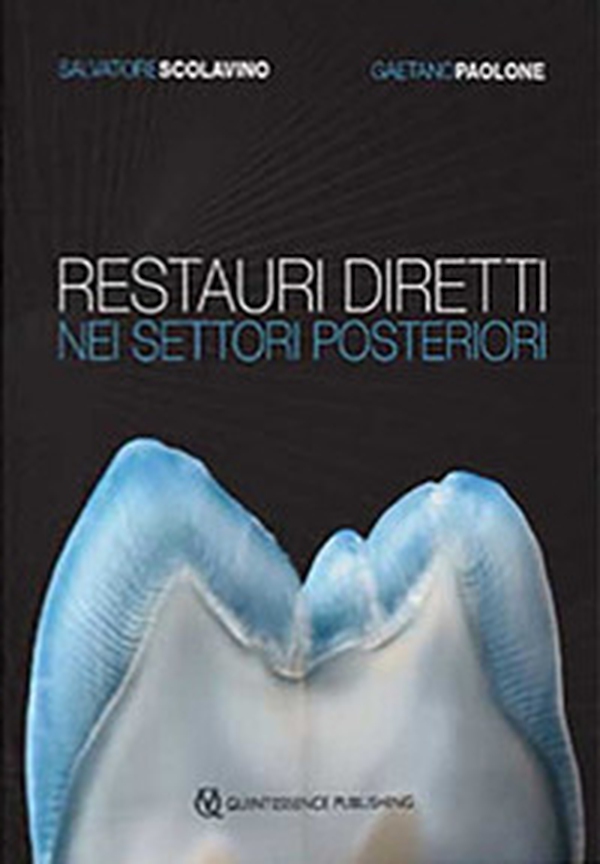 Restauri diretti nei settori posteriori - Librerie.coop Restauri diretti nei settori posteriori - Librerie.coop