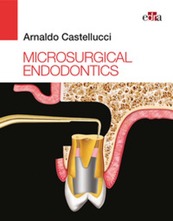 Microsurgical endodontics - Librerie.coop Microsurgical endodontics - Librerie.coop