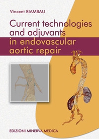 Current technologies and adjuvants in endovascular aortic repair - Librerie.coop
