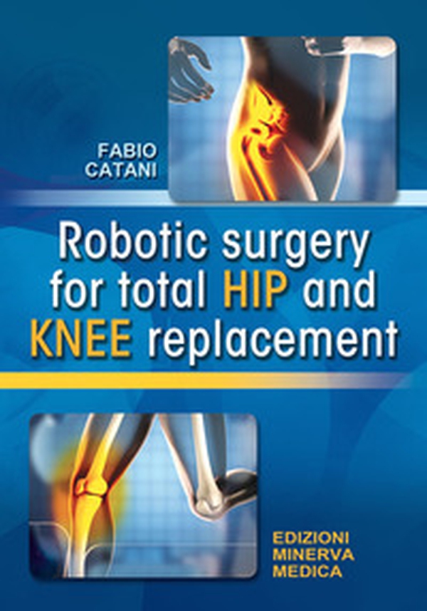 Robotic surgery for total hip and knee replacement - Librerie.coop
