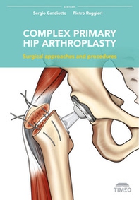 Complex primary hip arthroplasty. Surgical approaches and procedures - Librerie.coop