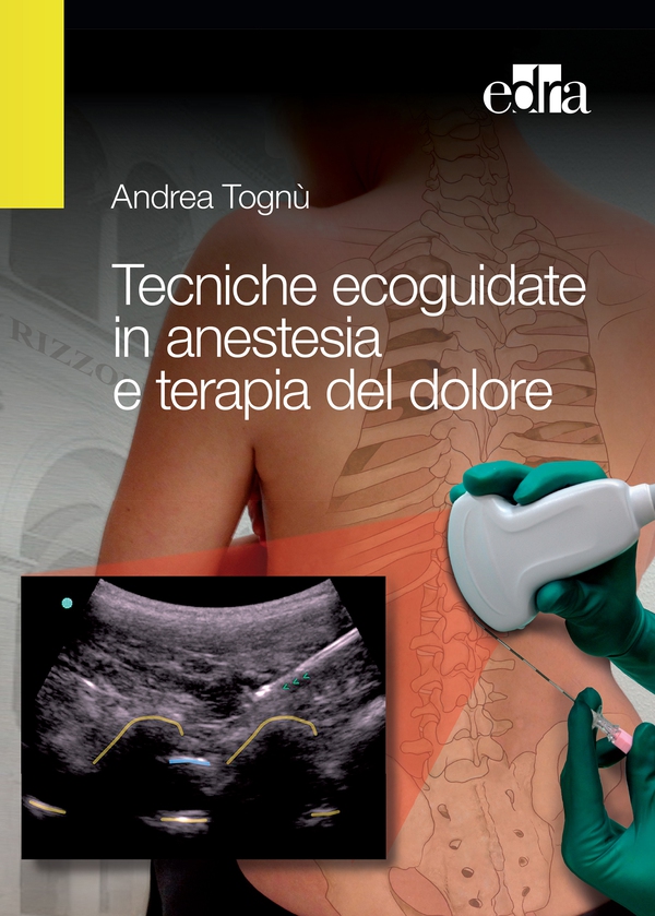 Tecniche ecoguidate in anestesia e terapia del dolore - Librerie.coop