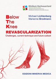 Below the knee revascularization. Challenges, current technique and future outlook - Librerie.coop