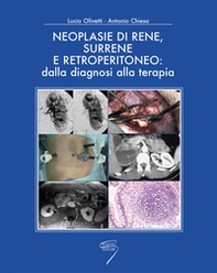Neoplasie di rene, surrene e retroperitioneo: dalla diagnosi alla terapia - Librerie.coop