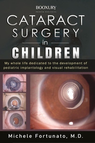Cataract surgery in children - Librerie.coop