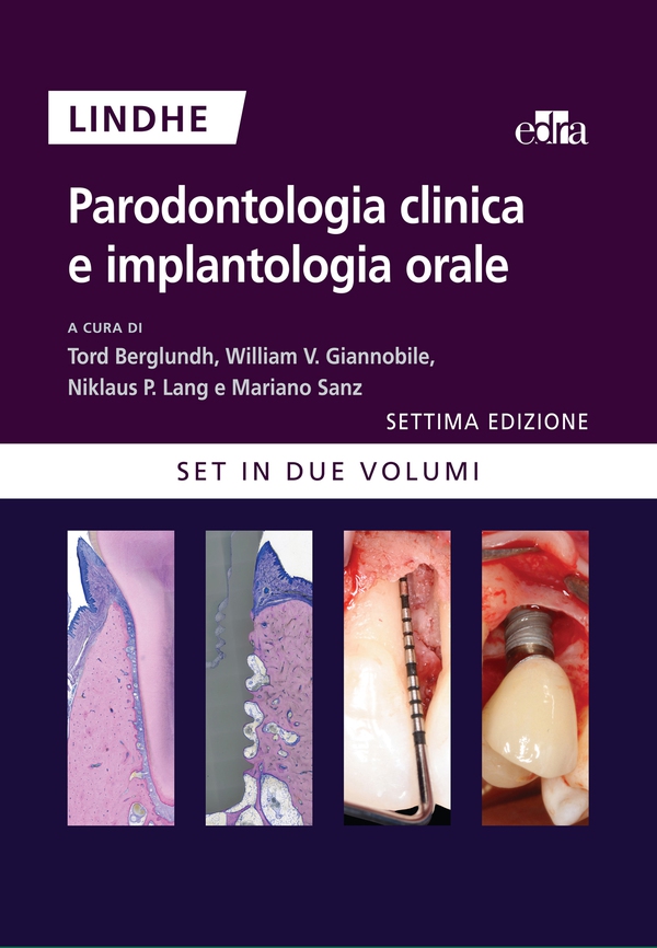 Parodontologia clinica e implantologia orale - Librerie.coop Parodontologia clinica e implantologia orale - Librerie.coop