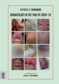 Dermatology in the time of Covid-19 - Librerie.coop