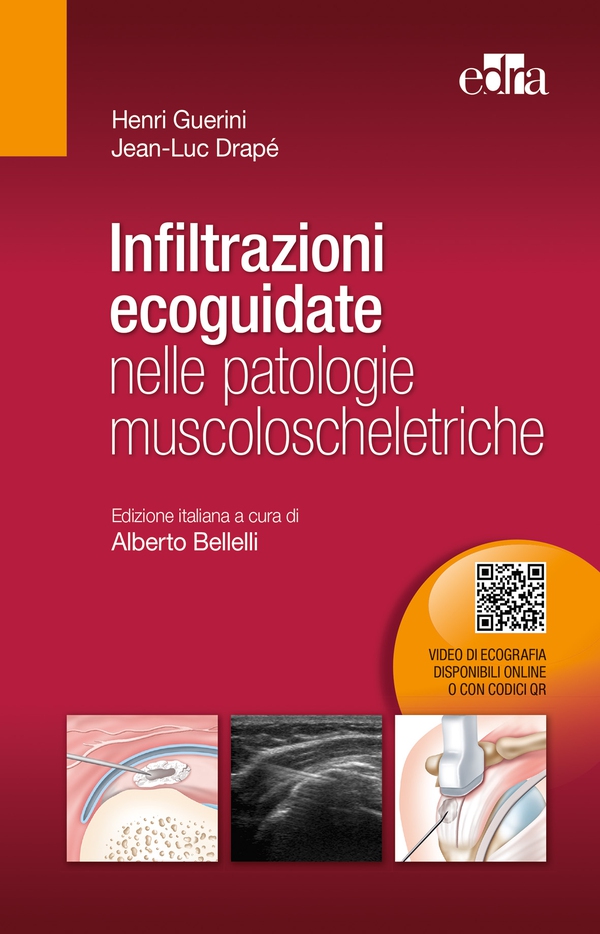 Infiltrazioni ecoguidate nelle patologie muscoloscheletriche - Librerie.coop Infiltrazioni ecoguidate nelle patologie muscoloscheletriche - Librerie.coop