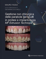 Gestione non chirurgica delle parabole gengivali in protesi e implantologia. MF extrusion technique - Librerie.coop