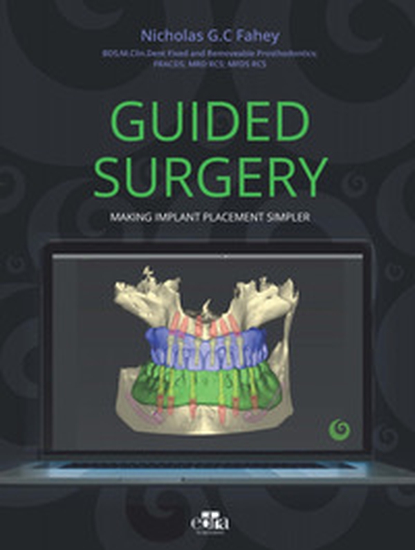Guided surgery. Making implant placement simpler - Librerie.coop Guided surgery. Making implant placement simpler - Librerie.coop