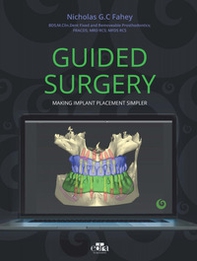Guided surgery. Making implant placement simpler - Librerie.coop