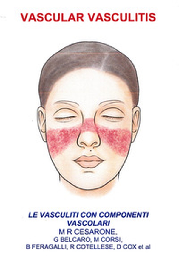 Vascular vasculitis. Vasculiti con componenti vascolari - Librerie.coop Vascular vasculitis. Vasculiti con componenti vascolari - Librerie.coop