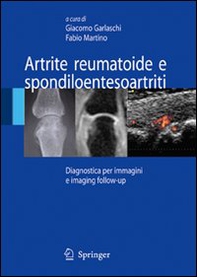 Artrite reumatoide e spondiloentesoartriti - Librerie.coop