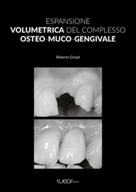 Espansione volumetrica del complesso osteo-muco-gengivale - Librerie.coop