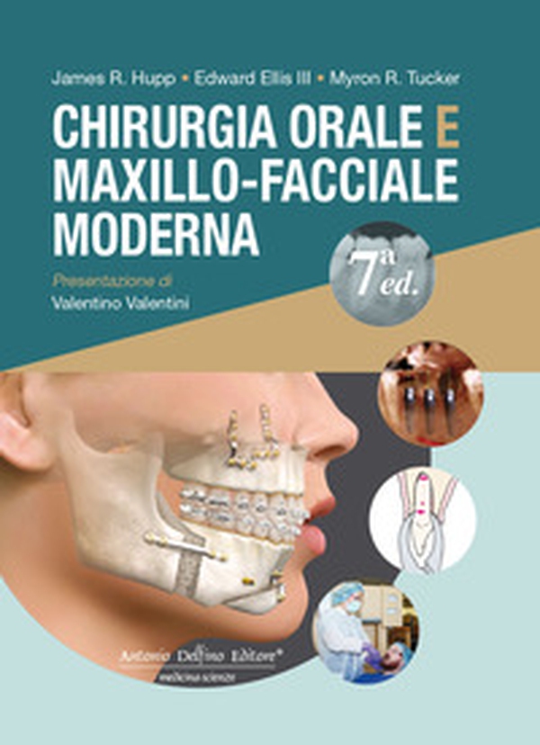 Chirurgia orale e maxillo-facciale moderna - Librerie.coop Chirurgia orale e maxillo-facciale moderna - Librerie.coop