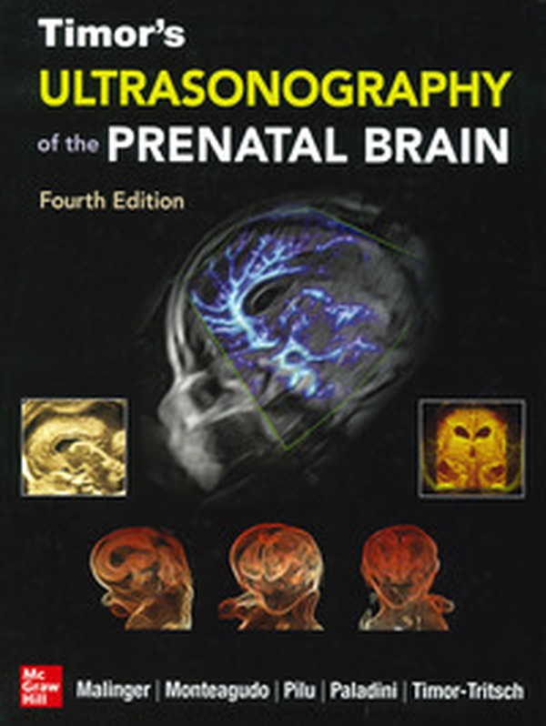 Ultrasonography of the prenatal brain - Librerie.coop Ultrasonography of the prenatal brain - Librerie.coop
