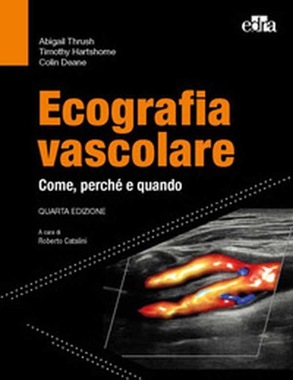 Ecografia vascolare. Come, perché e quando - Librerie.coop Ecografia vascolare. Come, perché e quando - Librerie.coop