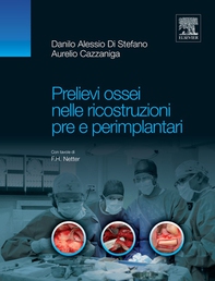 Prelievi ossei nelle ricostruzioni pre e perimplantari - Librerie.coop Prelievi ossei nelle ricostruzioni pre e perimplantari - Librerie.coop