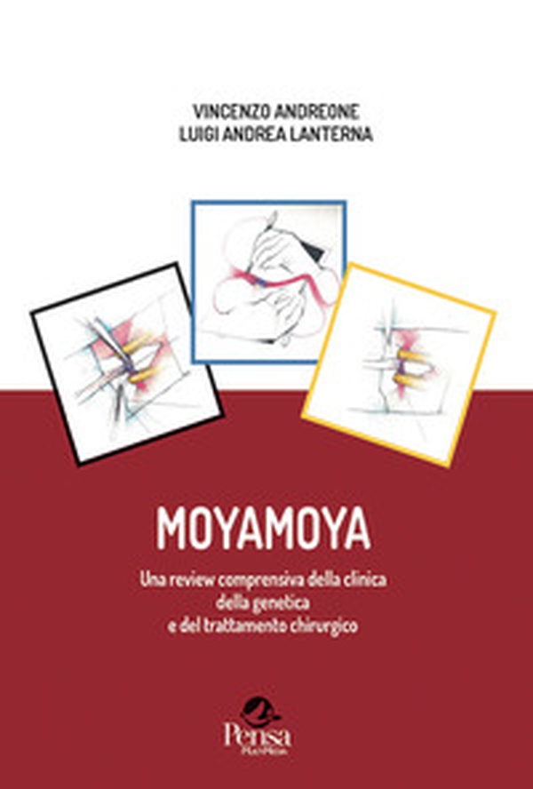 Moyamoya. Una review comprensiva della clinica della genetica e del trattamento chirurgico - Librerie.coop Moyamoya. Una review comprensiva della clinica della genetica e del trattamento chirurgico - Librerie.coop