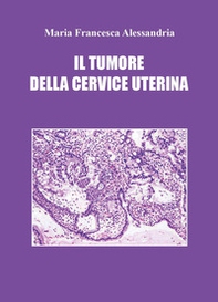 Il tumore della cervice uterina - Librerie.coop