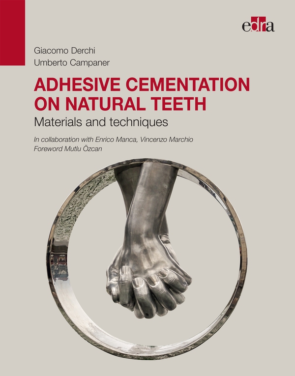 Adhesive cementation on natural teeth - Librerie.coop Adhesive cementation on natural teeth - Librerie.coop