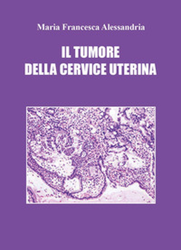 Il tumore della cervice uterina - Librerie.coop Il tumore della cervice uterina - Librerie.coop