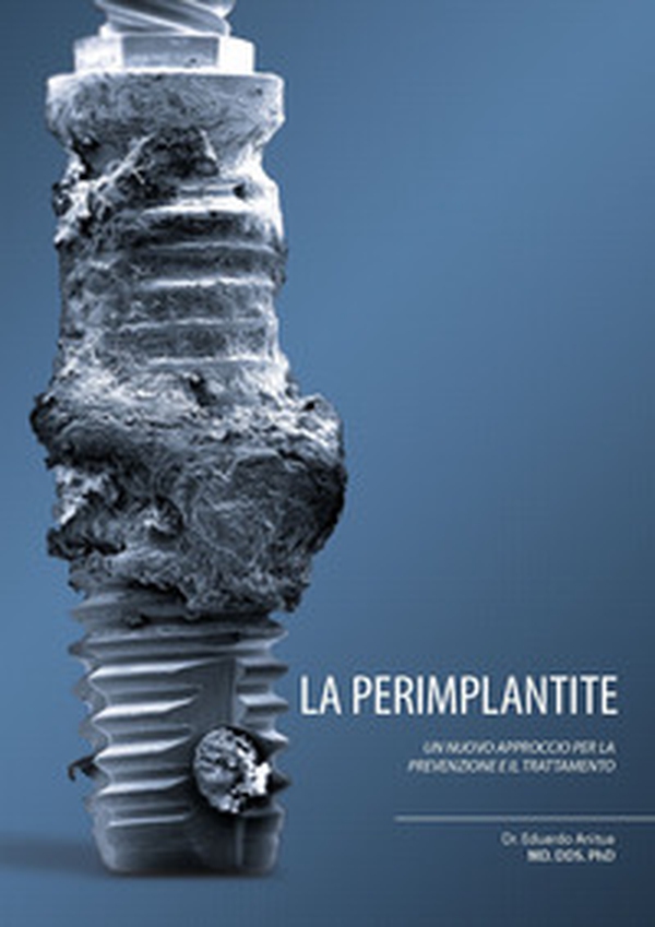 La perimplantite. Un nuovo approccio alla prevenzione e al suo trattamento - Librerie.coop La perimplantite. Un nuovo approccio alla prevenzione e al suo trattamento - Librerie.coop