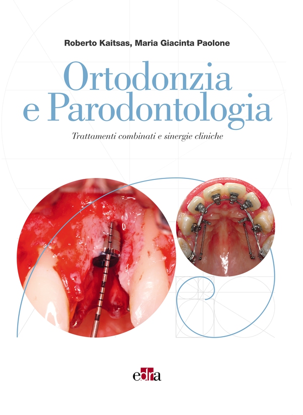 Ortodonzia e parodontologia - Librerie.coop Ortodonzia e parodontologia - Librerie.coop