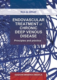 Endovascular treatment of chronic deep venous disease. Principles and practice - Librerie.coop
