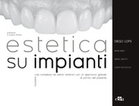 Estetica su impianti. Risolvere casi complessi nei settori anteriori con un approccio globale al sorriso del paziente - Librerie.coop