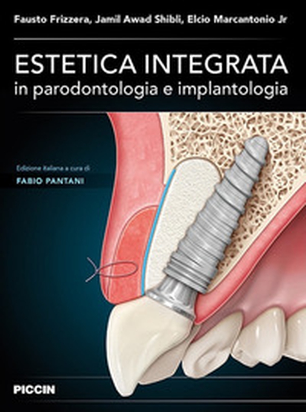 Estetica integrata in parodontologia e implantologia - Librerie.coop Estetica integrata in parodontologia e implantologia - Librerie.coop