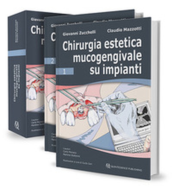 Chirurgia estetica mucogengivale su impianti - Librerie.coop Chirurgia estetica mucogengivale su impianti - Librerie.coop