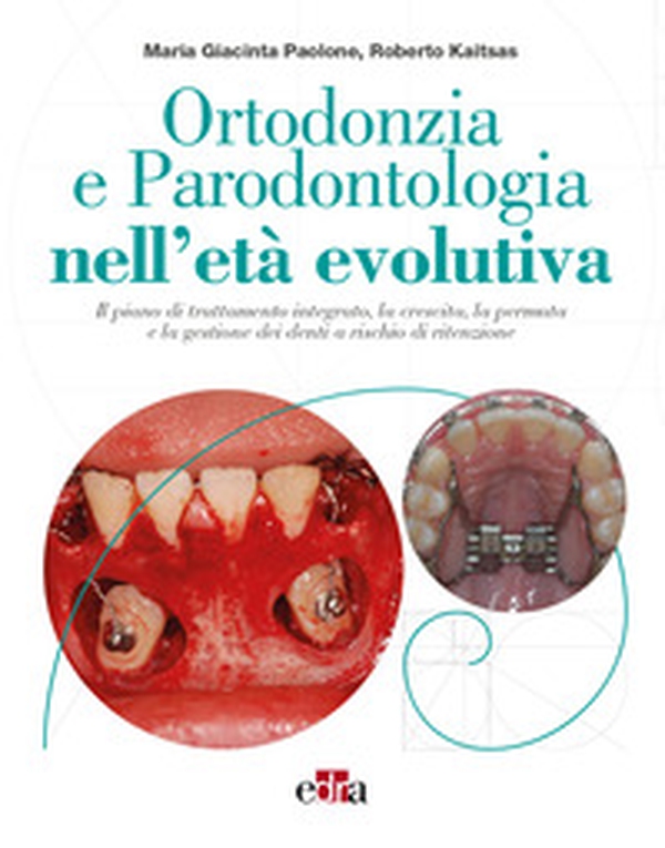 Ortodonzia e parodontologia nell'età evolutiva. Il piano di trattamento integrato, la crescita, la permuta e la gestione dei denti a rischio di ritenzione - Librerie.coop Ortodonzia e parodontologia nell'età evolutiva. Il piano di trattamento integrato, la crescita, la permuta e la gestione dei denti a rischio di ritenzione - Librerie.coop