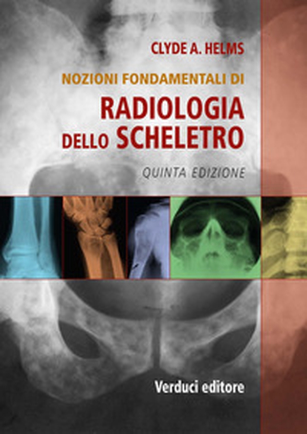 Radiologia dello scheletro. Nozioni fondamentali - Librerie.coop