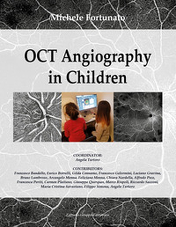 OCT. Angiography in children - Librerie.coop