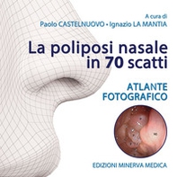 La poliposi nasale in 70 scatti. Atlante fotografico - Librerie.coop
