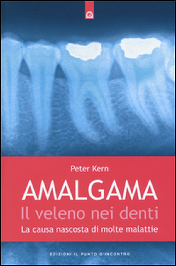 Amalgama. Il veleno nei denti. La causa nascosta di molte malattie - Librerie.coop Amalgama. Il veleno nei denti. La causa nascosta di molte malattie - Librerie.coop