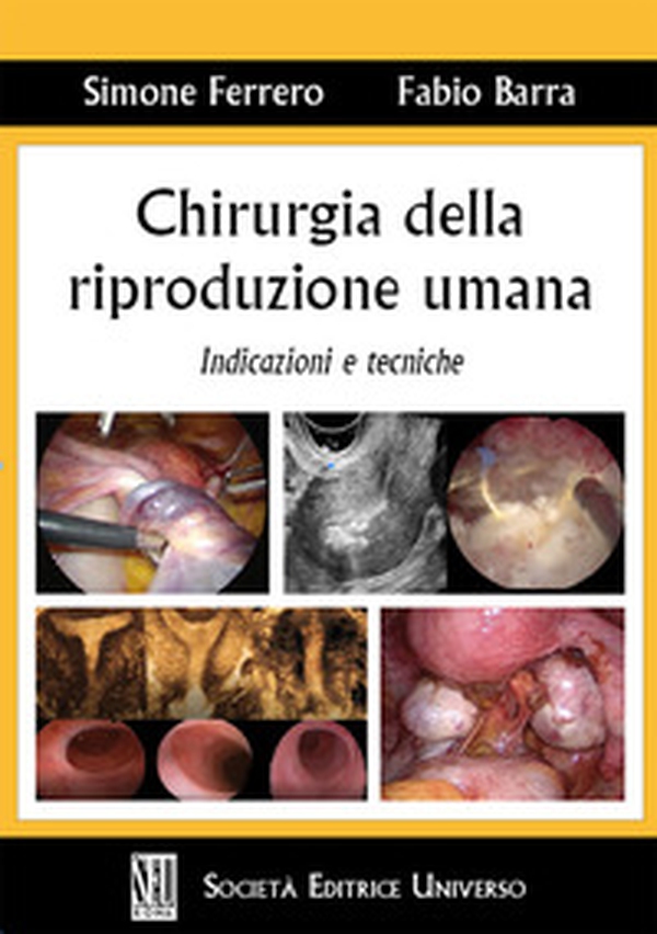 Chirurgia della riproduzione umana. Indicazioni e tecniche - Librerie.coop Chirurgia della riproduzione umana. Indicazioni e tecniche - Librerie.coop