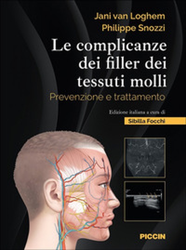 Le complicanze dei filler dei tessuti molli. Prevenzione e trattamento - Librerie.coop Le complicanze dei filler dei tessuti molli. Prevenzione e trattamento - Librerie.coop