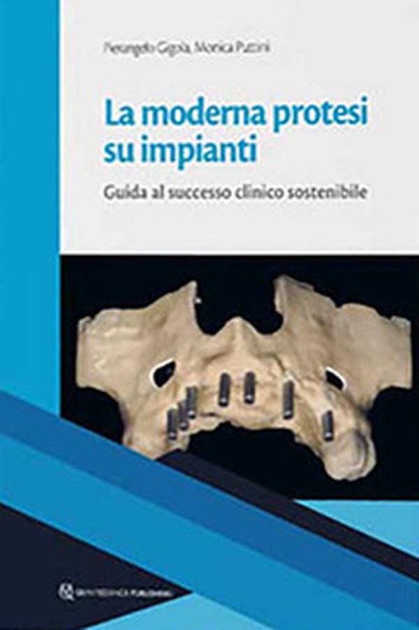 La moderna protesi su impianti. Guida la successo clinico sostenibile - Librerie.coop La moderna protesi su impianti. Guida la successo clinico sostenibile - Librerie.coop