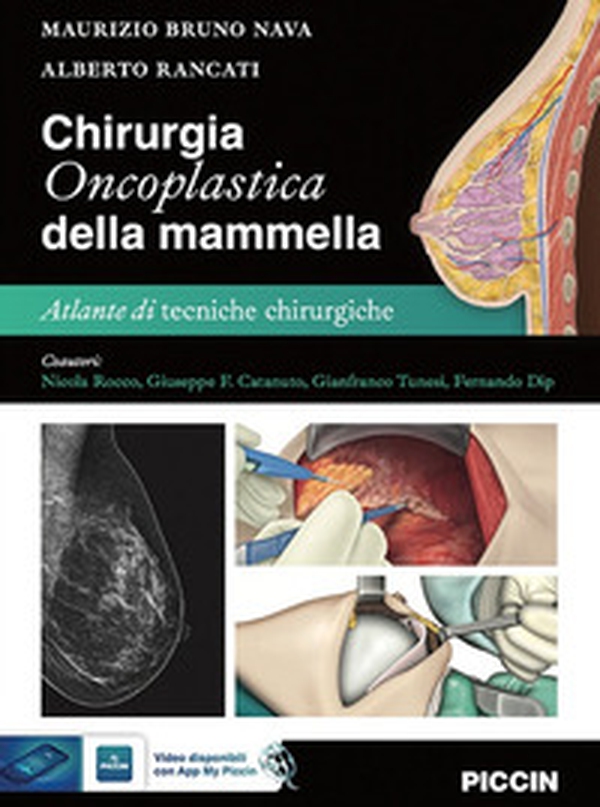 Chirurgia oncoplastica della mammella. Atlante di tecniche chirurgiche - Librerie.coop Chirurgia oncoplastica della mammella. Atlante di tecniche chirurgiche - Librerie.coop