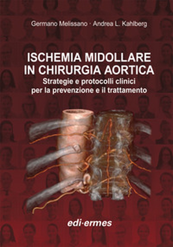 Ischemia midollare in chirurgia aortica. Strategie e protocolli clinici per la prevenzione e il trattamento - Librerie.coop Ischemia midollare in chirurgia aortica. Strategie e protocolli clinici per la prevenzione e il trattamento - Librerie.coop