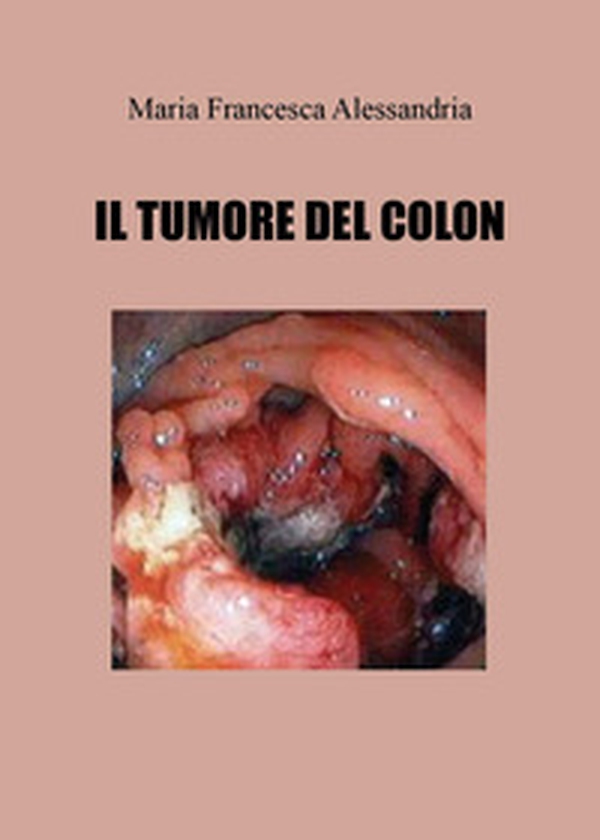 Il tumore del colon - Librerie.coop Il tumore del colon - Librerie.coop