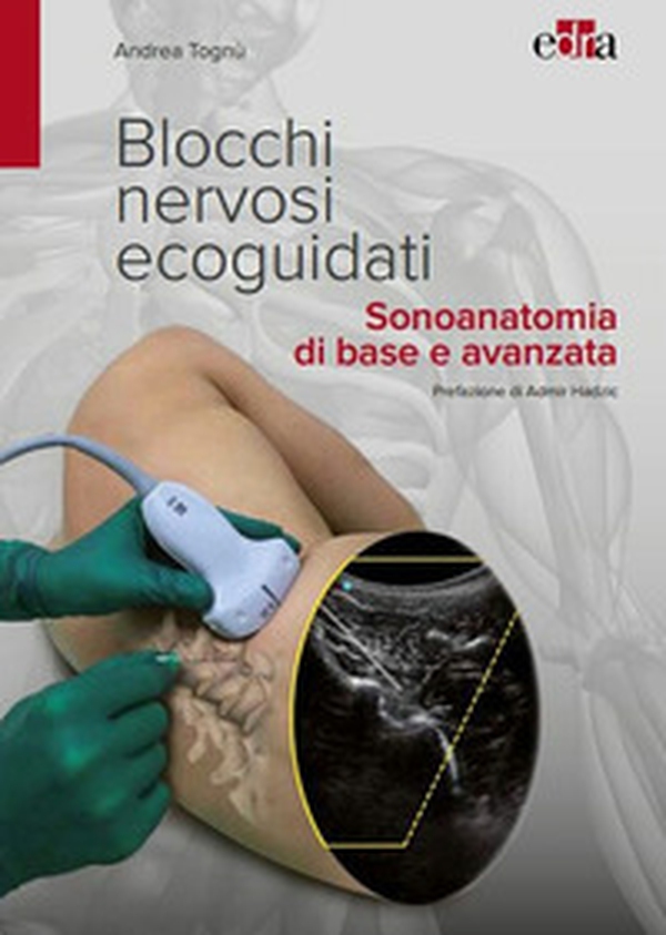 Blocchi nervosi ecoguidati. Sonoanatomia di base avanzata - Librerie.coop Blocchi nervosi ecoguidati. Sonoanatomia di base avanzata - Librerie.coop