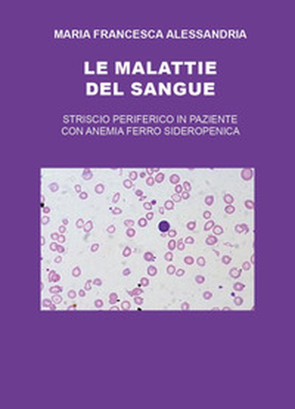 Le malattie del sangue - Librerie.coop Le malattie del sangue - Librerie.coop
