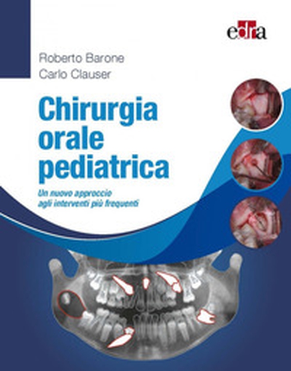 Chirurgia orale pediatrica. Un nuovo approccio agli interventi più frequenti - Librerie.coop Chirurgia orale pediatrica. Un nuovo approccio agli interventi più frequenti - Librerie.coop