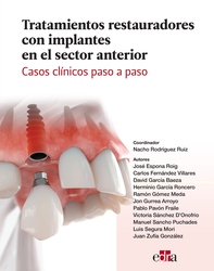 Tratamientos restauradores con implantes en el sector anterior. Casos clínicos paso a paso - Librerie.coop