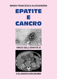 Epatite e cancro - Librerie.coop